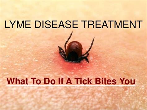 Lyme Disease Auf Deutsch Captions Pages