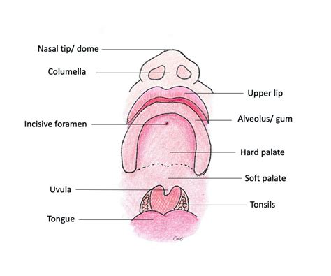 Facial Formation Cleft Lip And Palate Explained Cleft Care Ireland