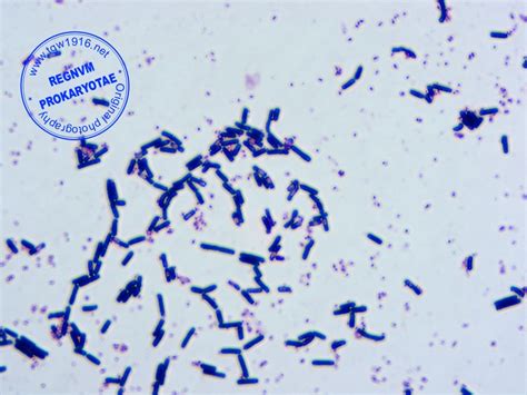 Bacillus Cereus Gram Stain