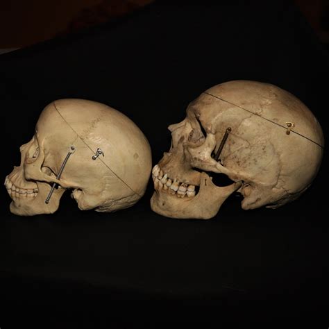 Sold European Male Skull Oddarticulations Llc