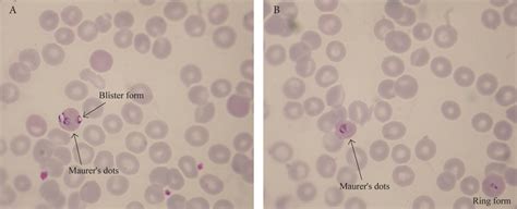 Microscopical Diagnosis Of Blood Parasites Haema