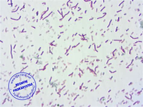 Regnum Prokaryotae Microscope Images