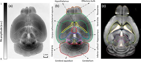 Label Free Photoacoustic Tomography Of Whole Mouse Brain Structures Ex Vivo