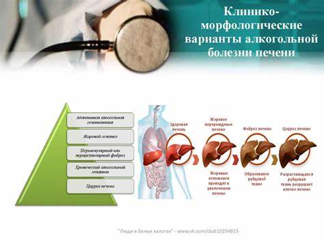 Алкогольная болезнь печени - презентация онлайн Картинка - Алкогольная болезнь печени - презентация онлайн