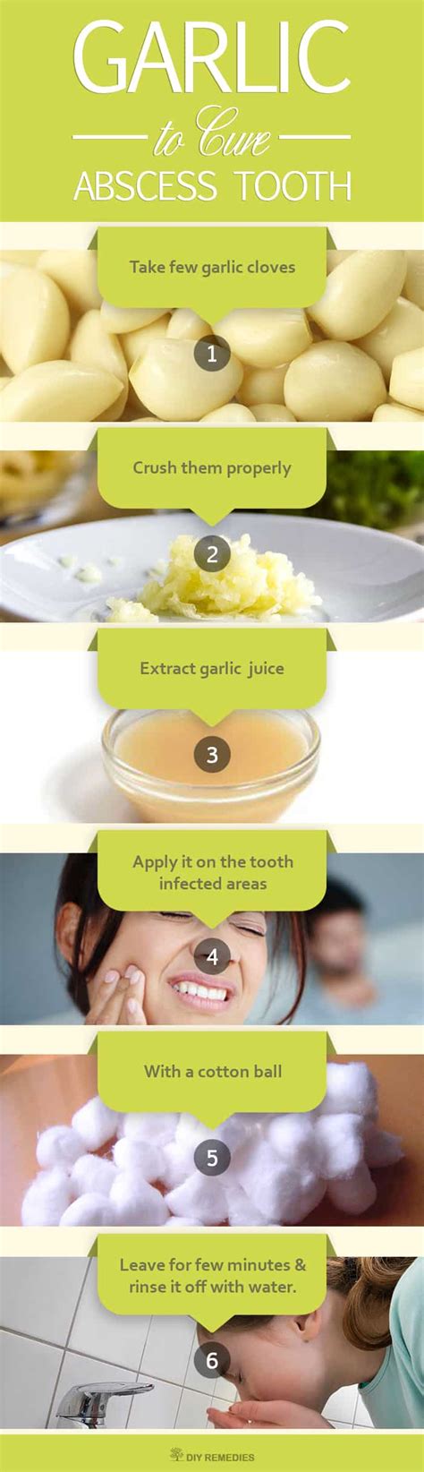 Natural Remedies To Cure Abscess Tooth