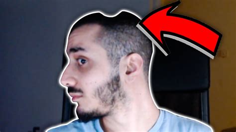 Do I Have A Dent In My Head Stream Highlights 15 Youtube