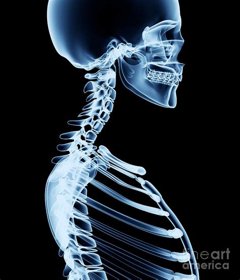 X Ray Skeleton Art