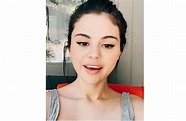 Selena Gomez muestra en video los tristes estragos del lupus | Viva la ...