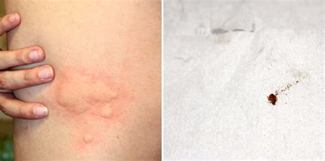 5 Signs Bed Bugs Leave Everywhere They Go Debedbug