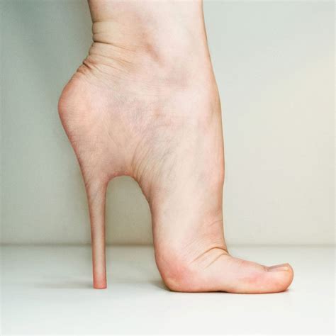 Cinderella Foot Plastic Surgery Cute Name Terrifying Procedure On