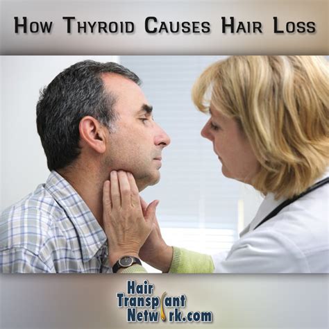 How Thyroid Causes Hair Loss