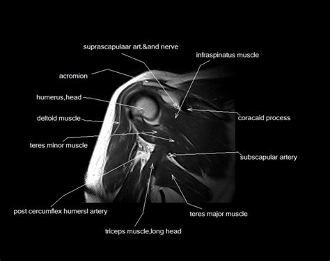 Find out about how the different muscles of the knee work and how they get injured. MRI shoulder anatomy | shoulder coronal anatomy | free cross sectional anatomy | | Shoulder ...