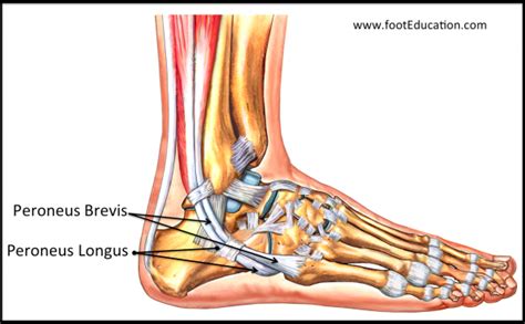 Acute Peroneal Tendon Subluxation Footeducation