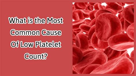 What Is The Most Common Cause Of Low Platelet Count Youtube