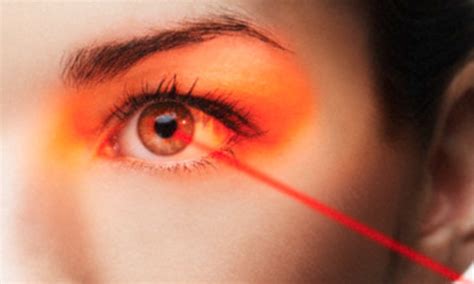 Could A 90 Second Procedure Banish The Risks Of Laser Eye Surgery New