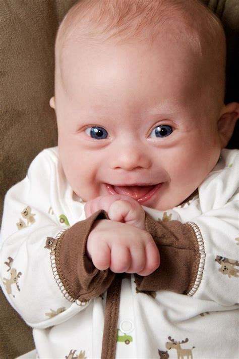 Baby With Down Syndrome Baby Kind Little Babies Baby Love Cute