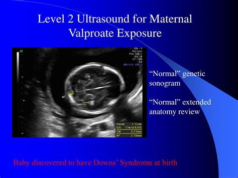 Ppt Presentation On Ultrasound