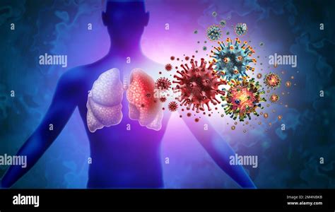Triple Virus Infección pulmonar y Tripledémica Infección pulmonar humana y enfermedad de