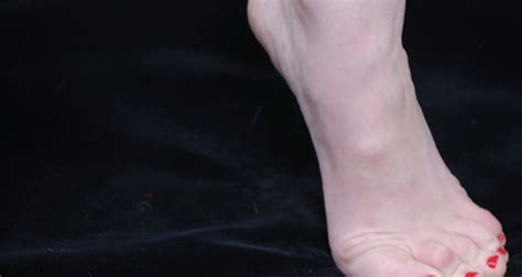 What Are The Signs And Symptoms Of Blood Clots In The Foot