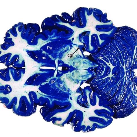 Horizontal Mulligan Stained Section Of The Human Brain At The Level Of