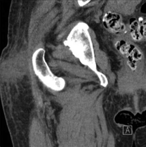 Case 272 Radiology
