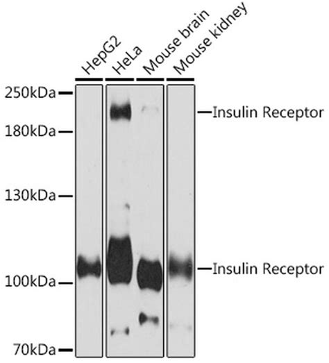 Insr Antibody Pa5 120502