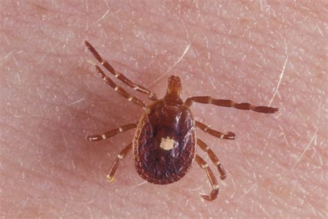 Tick Disease Cannot Eat Meat Pregnant Center Informations
