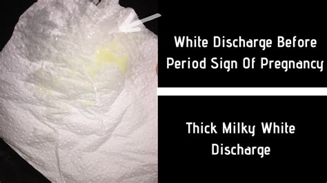 Has there been a yellow discharge before period, lately? Is White Discharge Before Period 1st Sign Of Pregnancy ...