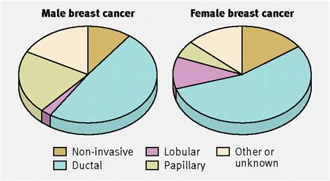 Gynaecomastia And Breast Cancer In Men The Bmj