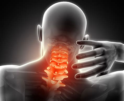 When Rheumatoid Arthritis Affects Cervical Spine Happiest Health
