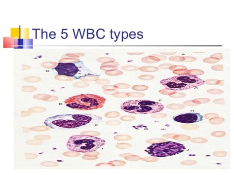 Abnormalities Of Wbc