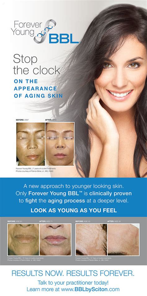 Forever Young Bbl Laser Sydney Infinity Skin Clinic