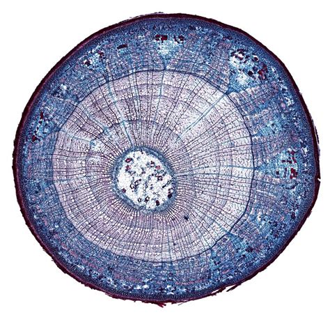 Microscopic Cross Section Cut Of A Plant Stem Under The Microscope