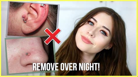 How To Get Rid Of Piercing Bumps Overnight Youtube