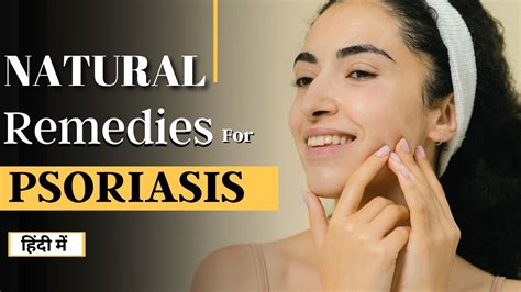 Best Home Remedies For Psoriasis सोरायसिस का इलाज Kapeefit Youtube