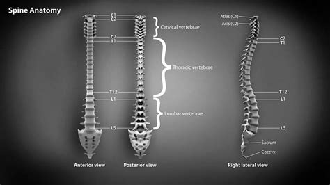 There is often more than one diagnosis, but an early and an exhaustive physical exam of all potential areas that could be the root cause of the problem is key in determining the correct diagnosis. Back Pain Definition - WelcomeCure