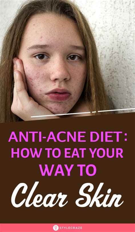 Anti Acne Diet What To Eat For Clearer And Healthier Skin Acne Diet