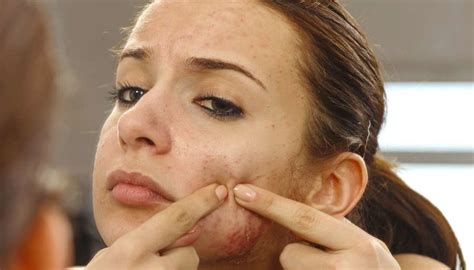 Infected Pimple Symptoms Diagnosis And Treatment