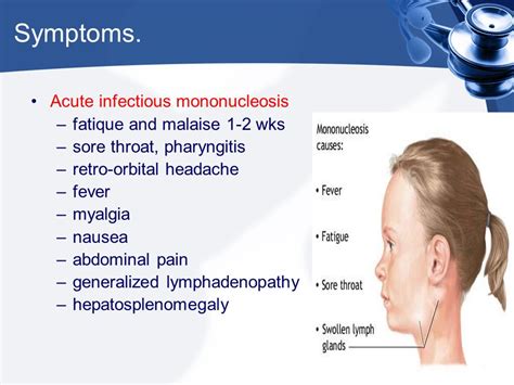 Pediatrics Notes Clinical Features Of Infectious Mononucleosis