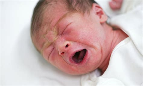 ¿por Qué Algunos Bebés Nacen Con Dientes Estilo De Vida Madres