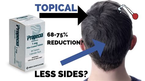 Topical Finasteride Science Pros And Cons And Practical Tips Youtube