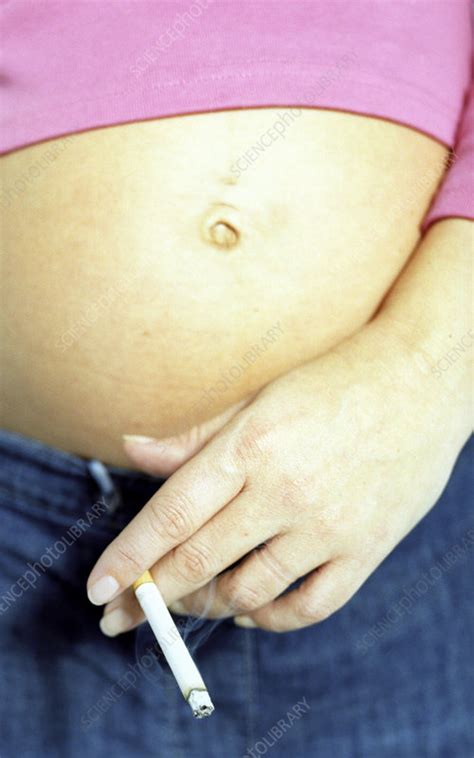 Smoking While Pregnant Stock Image M805 0733 Science Photo Library