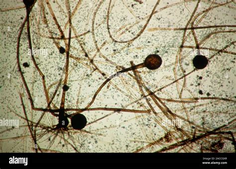 A Mucor Fungus Mature Sporangium Under A Light Microscope My Xxx Hot Girl