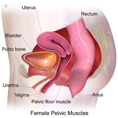 What Is Pelvic Prolapse And How Is It Treated Top Doctors