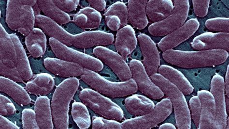 Flesh Eating Bacteria Linked To Deaths In New York And Connecticut