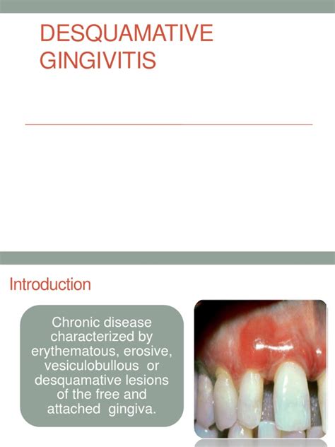 Desquamative Gingivitis Cutaneous Conditions Diseases And Disorders