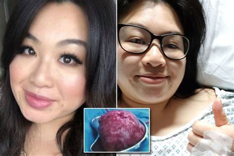 Dr Pimple Popper Lost For Words At Biggest Ever Lump Before Removing