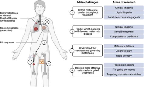 Current Challenges In The Management Of Metastatic Disease And Areas Of