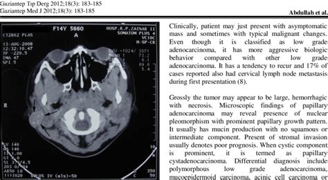 Axial View Of Ct Scan Showed A Well Defined Round Homogeneously