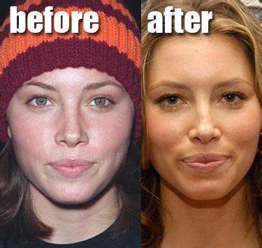 Jessica Biel Before And After Nose Job Celebrity Plastic Surgery Online